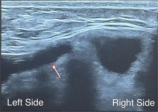 For image description, please refer to the figure legend and surrounding text.