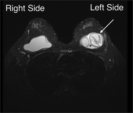 For image description, please refer to the figure legend and surrounding text.