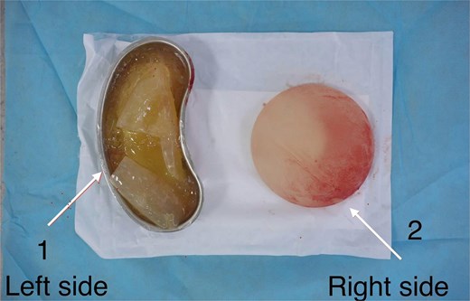 For image description, please refer to the figure legend and surrounding text.