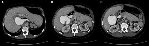 For image description, please refer to the figure legend and surrounding text.