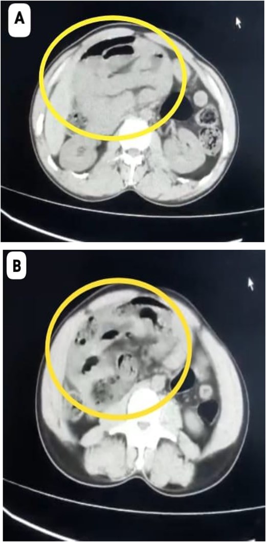 For image description, please refer to the figure legend and surrounding text.