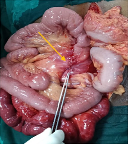 For image description, please refer to the figure legend and surrounding text.