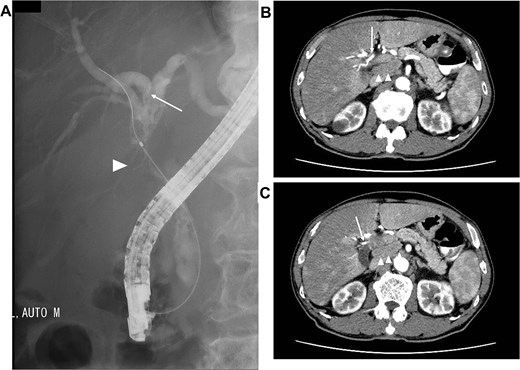 For image description, please refer to the figure legend and surrounding text.