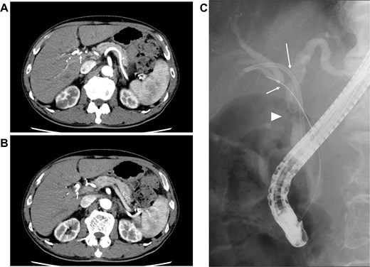 For image description, please refer to the figure legend and surrounding text.