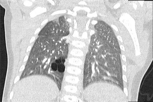 For image description, please refer to the figure legend and surrounding text.