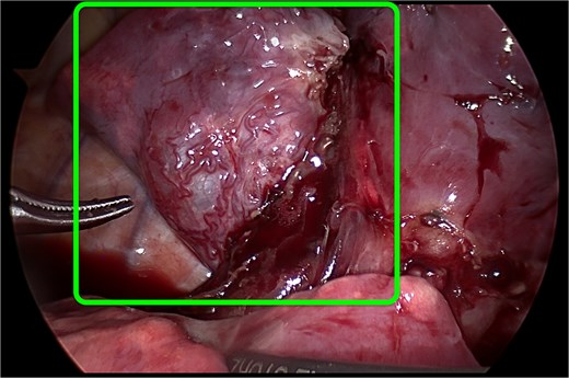 For image description, please refer to the figure legend and surrounding text.