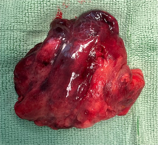 For image description, please refer to the figure legend and surrounding text.