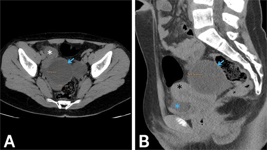 For image description, please refer to the figure legend and surrounding text.