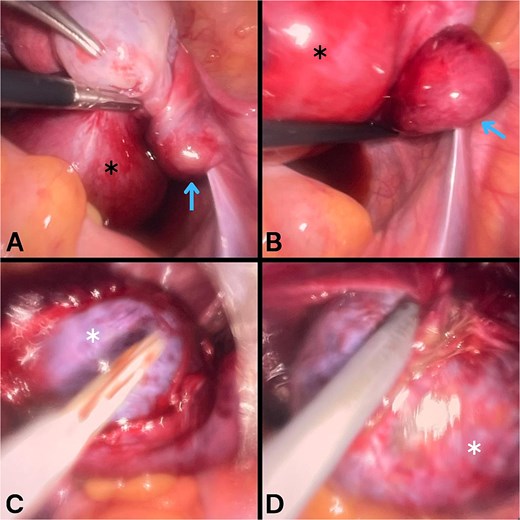For image description, please refer to the figure legend and surrounding text.