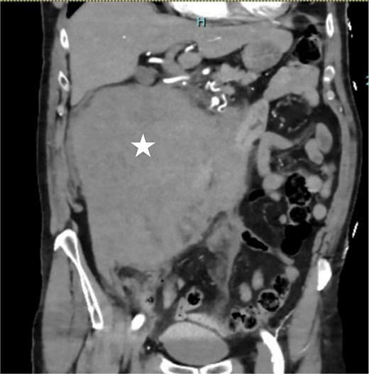 For image description, please refer to the figure legend and surrounding text.