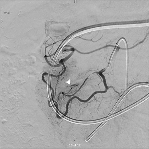 For image description, please refer to the figure legend and surrounding text.