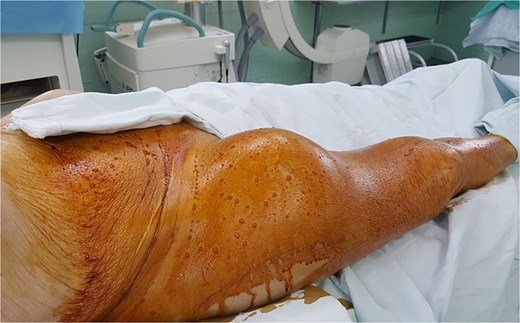 For image description, please refer to the figure legend and surrounding text.