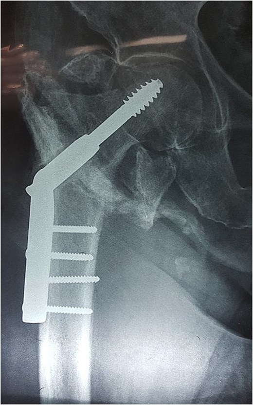 For image description, please refer to the figure legend and surrounding text.