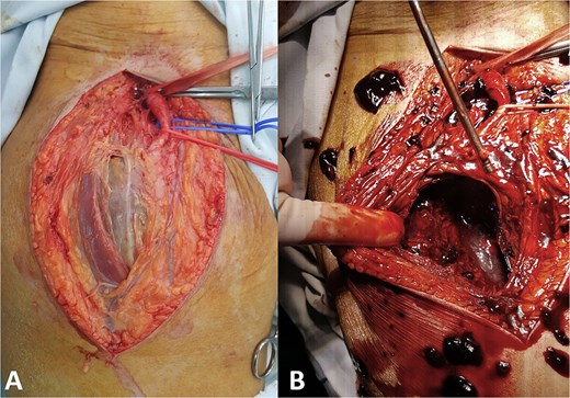 For image description, please refer to the figure legend and surrounding text.
