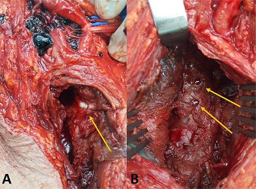 For image description, please refer to the figure legend and surrounding text.