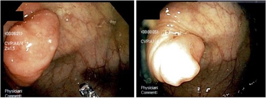 For image description, please refer to the figure legend and surrounding text.