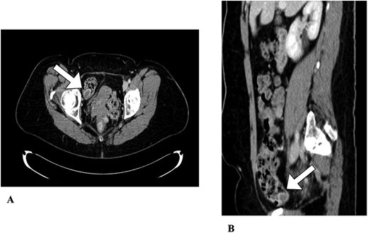 For image description, please refer to the figure legend and surrounding text.