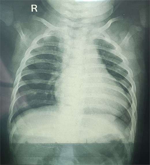 For image description, please refer to the figure legend and surrounding text.