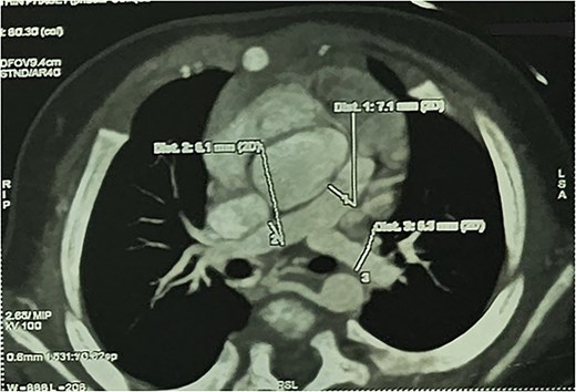 For image description, please refer to the figure legend and surrounding text.