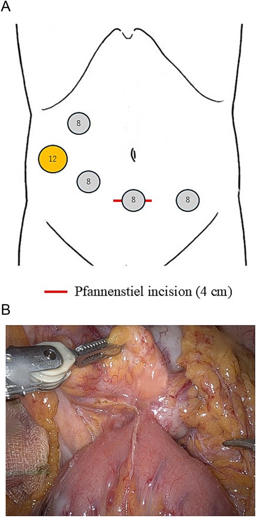 For image description, please refer to the figure legend and surrounding text.