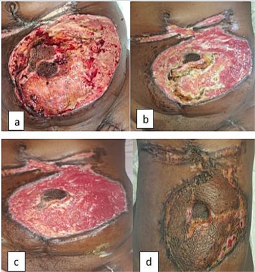 For image description, please refer to the figure legend and surrounding text.