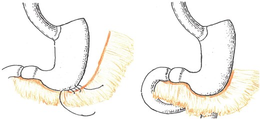 For image description, please refer to the figure legend and surrounding text.