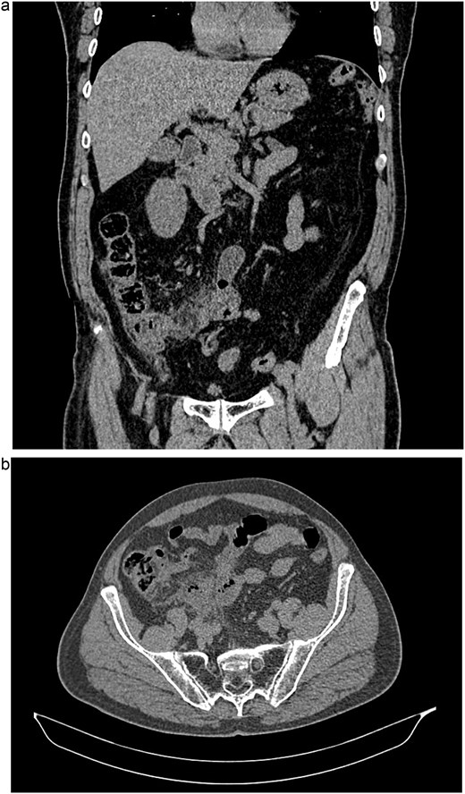 For image description, please refer to the figure legend and surrounding text.