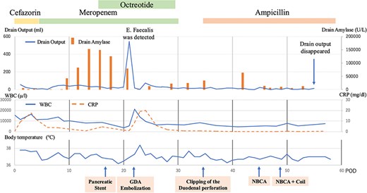 Graph showing the clinical course over time, including body temperature, white blood cell count, C-reactive protein levels, drain amylase levels, and drain output. The figure also includes annotations indicating the timing of treatments such as antibiotic administration, pancreatic duct stent placement, embolization, clipping, and NBCA administration.