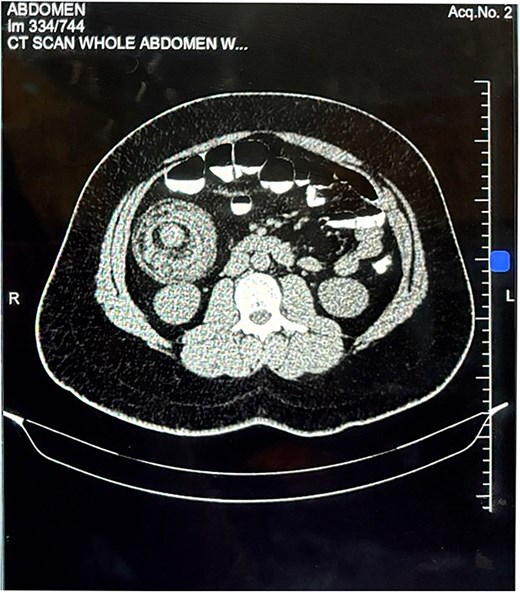 For image description, please refer to the figure legend and surrounding text.
