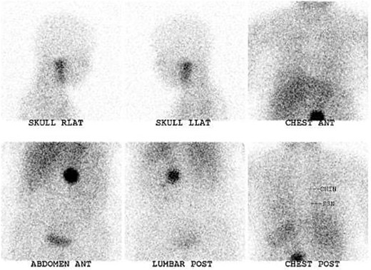 For image description, please refer to the figure legend and surrounding text.