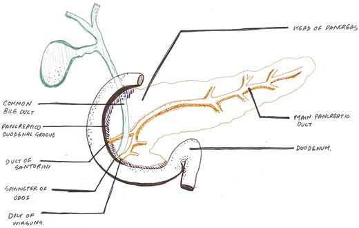 Hand-drawn anatomical diagram showing the C-shaped duodenum wrapped around the pancreatic head. The pancreaticoduodenal groove is clearly marked between the pancreatic head and duodenum, with the common bile duct entering from above and the main pancreatic duct, duct of Santorini, duct of Wirsung, and sphincter of Oddi labelled in the region of the ampulla.