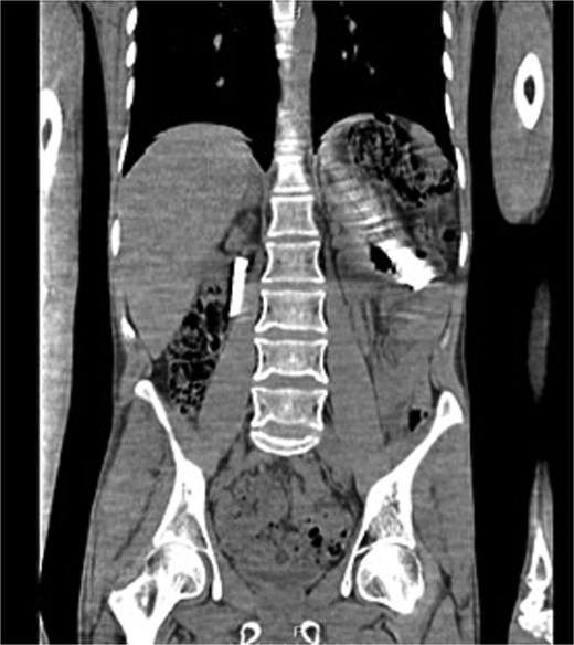 For image description, please refer to the figure legend and surrounding text.