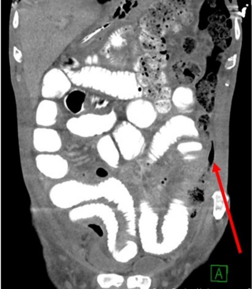 For image description, please refer to the figure legend and surrounding text.