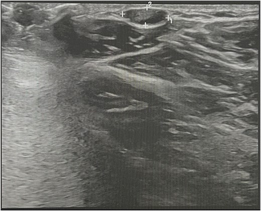 For image description, please refer to the figure legend and surrounding text.