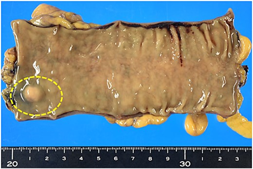 For image description, please refer to the figure legend and surrounding text.