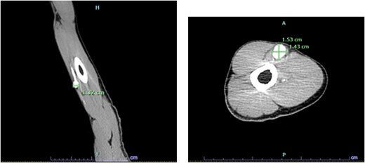 For image description, please refer to the figure legend and surrounding text.