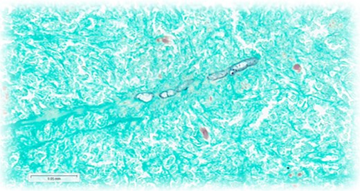 For image description, please refer to the figure legend and surrounding text.