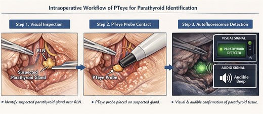 Diagram illustrating the intraoperative PTeye workflow for parathyroid identification during thyroidectomy, including visual inspection, probe contact, and autofluorescence confirmation.