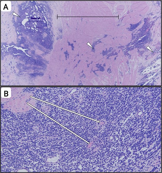 For image description, please refer to the figure legend and surrounding text.