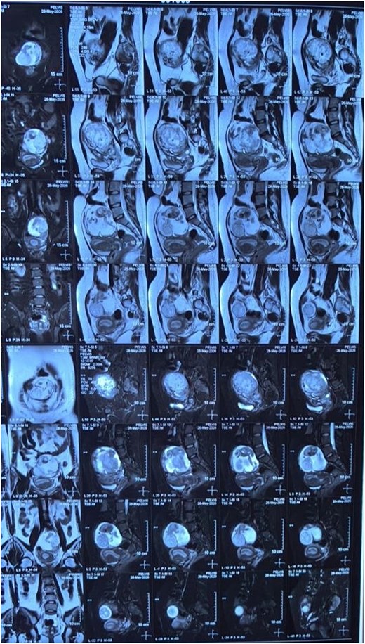 For image description, please refer to the figure legend and surrounding text.