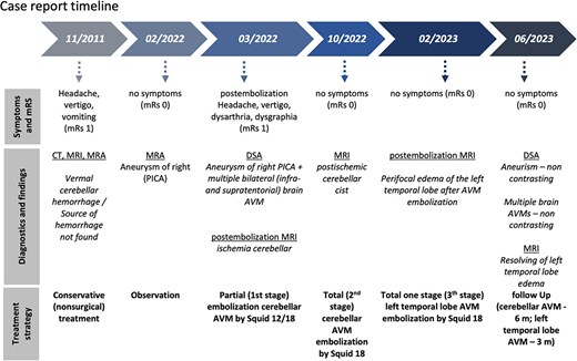 A clinical timeline flowchart from November 2011 to June 2023 tracking the patient case. It details the progression of symptoms, neuroimaging findings including a cerebellar hemorrhage and multiple arteriovenous malformations, and the step-by-step treatment strategy from initial conservative management to a three-stage total endovascular embolization.